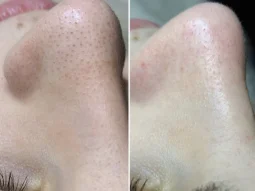 Metka studio на Демократической фотография 2