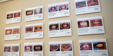 Стоматологическая клиника Зубы за один день фотография 1